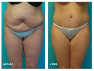 Nip/Tuck/Glow: Plastic Surgery Befores and Afters